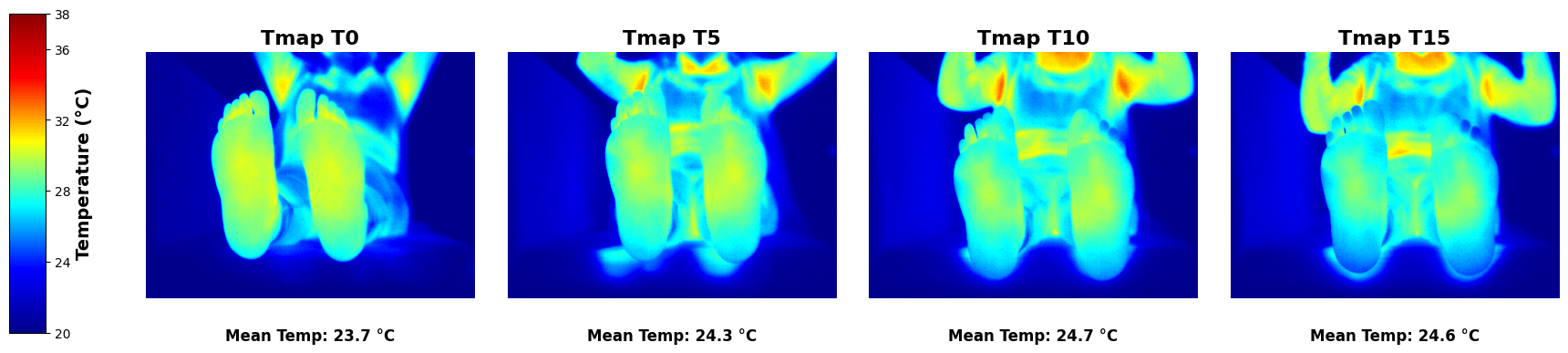 Termografías del pie de una persona voluntaria